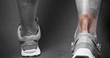 Aşil Tendon Yaralanması Belirtileri ve Tedavisi