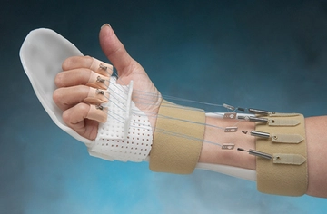 Tendon Kesisi Belirtileri ve Tedavisi